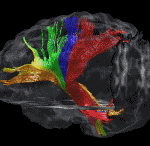Cerveau32