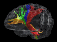 Cerveau32