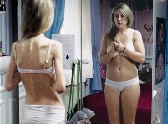 anorexiquembreux-blogs