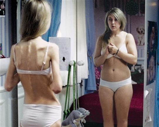 anorexiquembreux-blogs