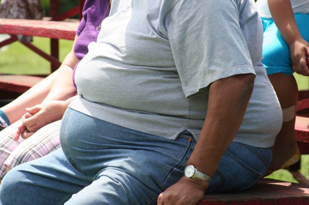 obesitee