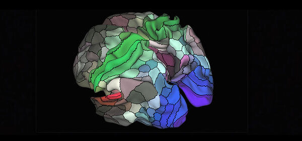 cerveau