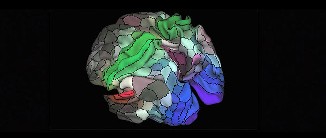 cerveau