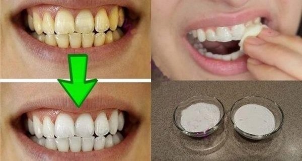 Blanchissez-vos-dents