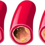 10_aliments_qui_débouchent_vos-01