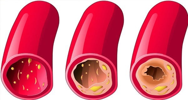 10_aliments_qui_débouchent_vos-01