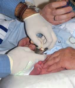 circoncision2
