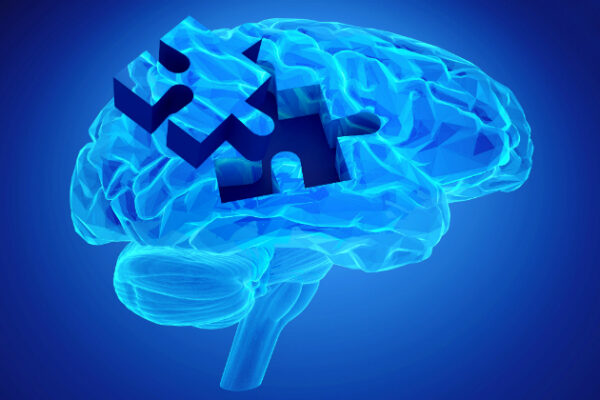 Alzheimer3