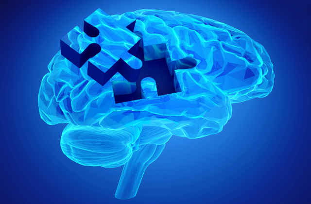 Alzheimer3