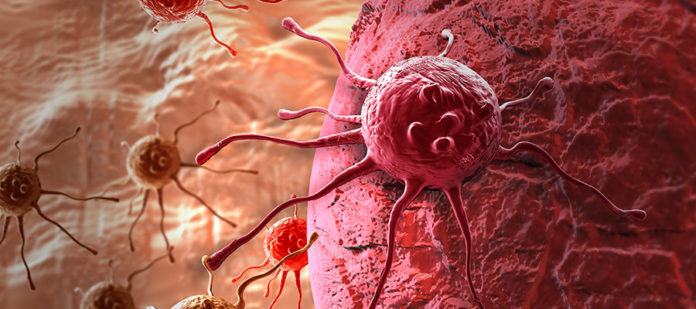 Cancer-696x309