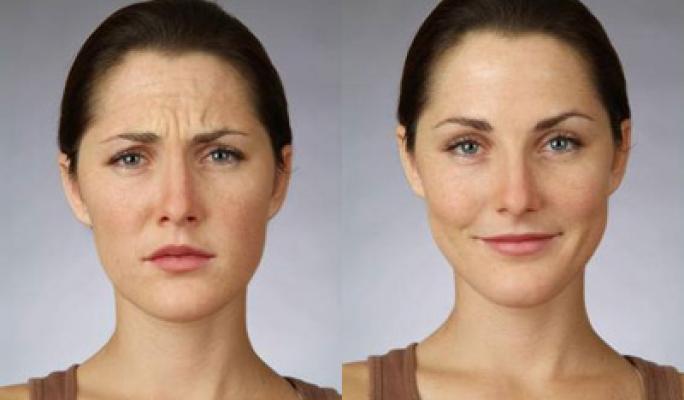 botox-party-marrackech