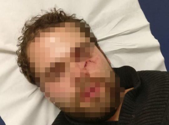 France-Israeli-student-brutally-attacke