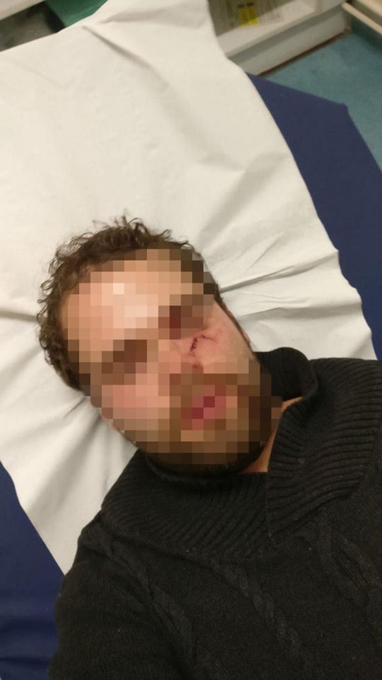 France-Israeli-student-brutally-attacke