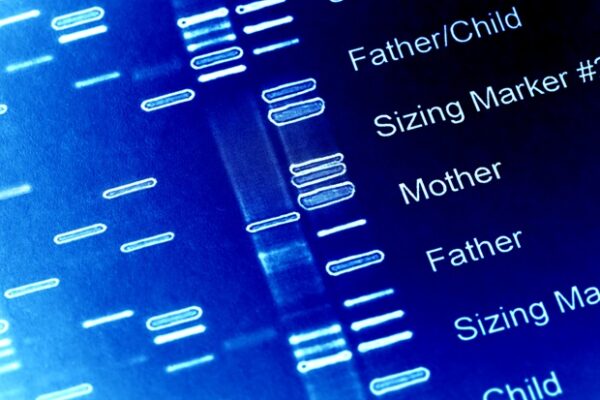 De nouveaux facteurs de risque génétiques pour la maladie d’Alzheimer propres aux juifs ashkénazes identifiés variantes-genetiques